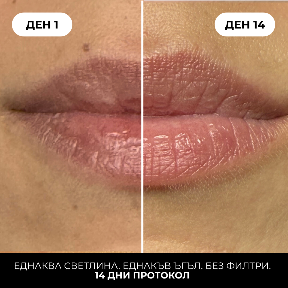 Applying the MUSE overnight lip mask before bed and the effect